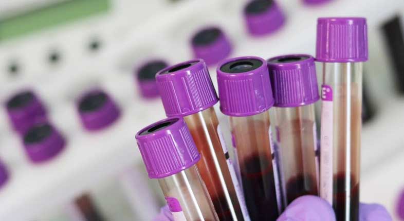 labtesting